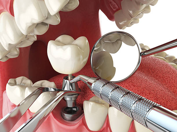 Best Weekend Emergency Dentist in Matthews, NC